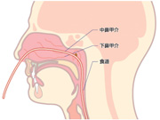 鼻からの胃カメラ（経鼻内視鏡検査）